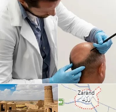 کاشت مو به روش تکثیری در زرند