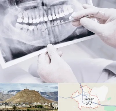 رادیولوژی دهان و دندان در گراش