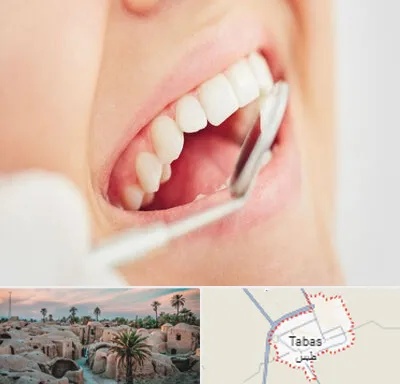 اصلاح طرح لبخند در طبس