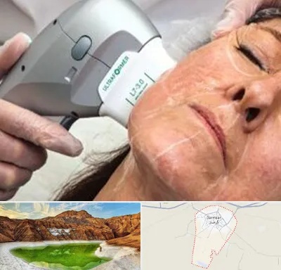 آموزش هایفوتراپی در گرمسار
