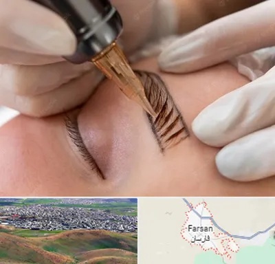 میکروبلیدینگ در فارسان