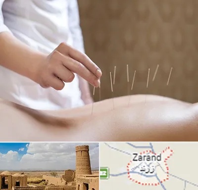درای نیدلینگ در زرند