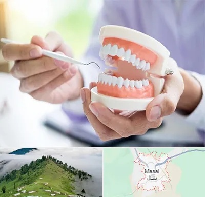 دندانسازی در ماسال