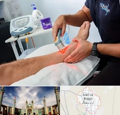 لیزر تراپی در آران و بیدگل
