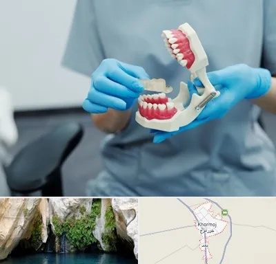 دندانپزشک خانم در خورموج