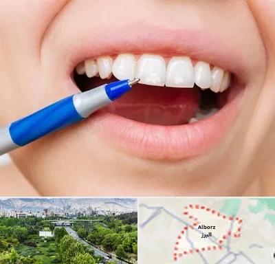 دندانسازی ارزان در البرز