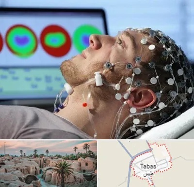 مرکز نوار مغز در طبس