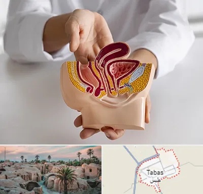 دکتر دستگاه تناسلی مردان در طبس