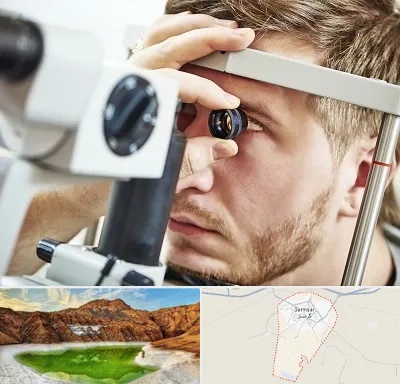فوق تخصص قرنیه در گرمسار