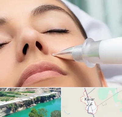 پلاسما جت بینی در کوار