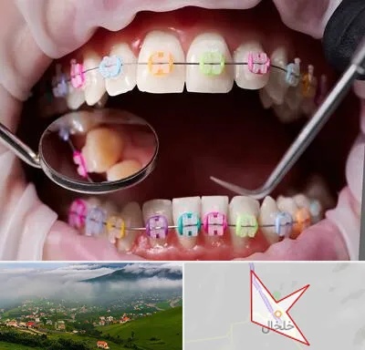 متخصص ارتودنسی در خلخال