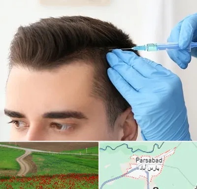 مزوتراپی مو در پارس آباد