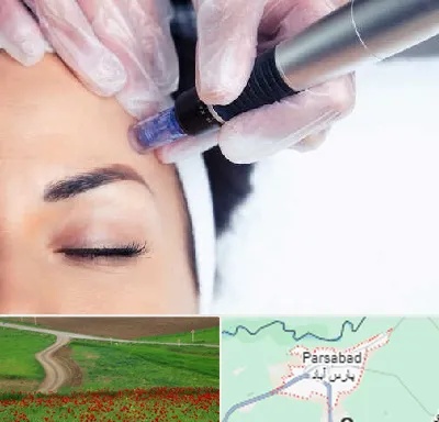 کلینیک مزوتراپی صورت در پارس آباد