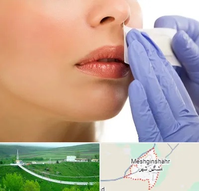 اپیلاسیون صورت در مشگین شهر
