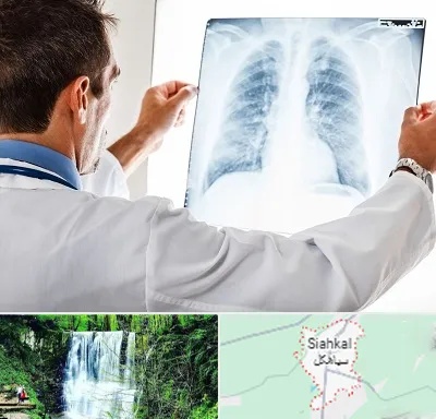 دکتر متخصص ریه در سیاهکل