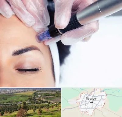 کلینیک مزوتراپی صورت در نقده