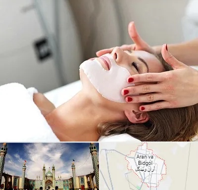 فیشیال صورت در آران و بیدگل