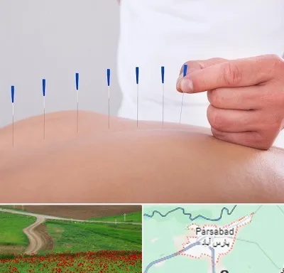 دکتر طب سوزنی در پارس آباد