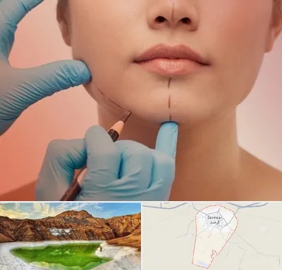 دکتر زیبایی خانم در گرمسار