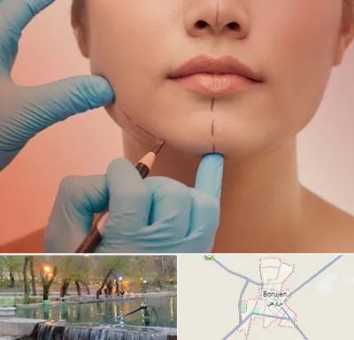 دکتر زیبایی خانم در بروجن