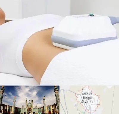 لاغری موضعی در آران و بیدگل