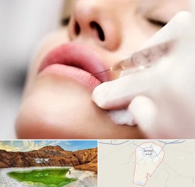 کلینیک تزریق ژل لب در گرمسار