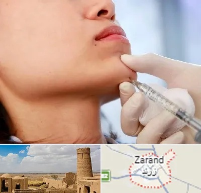زاویه سازی صورت در زرند