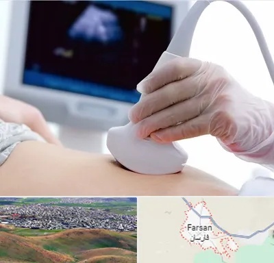 سونوگرافی در فارسان