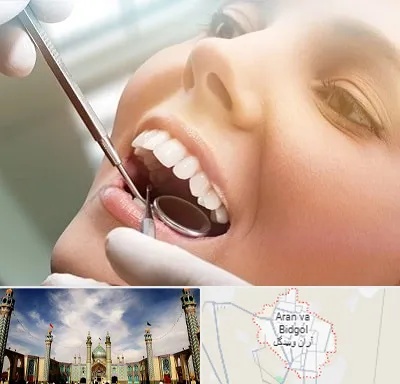 دندانپزشکی زیبایی در آران و بیدگل