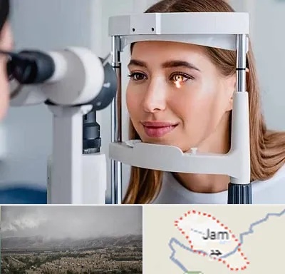 دکتر قوز قرنیه در جم