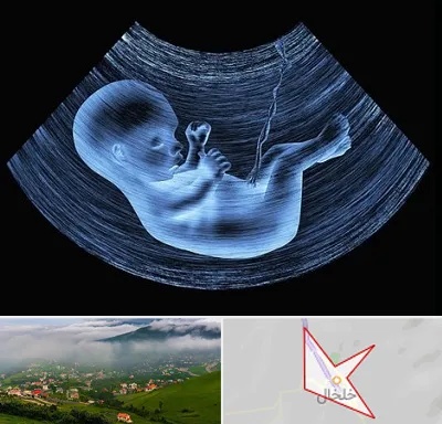 دکتر متخصص غربال گری در خلخال