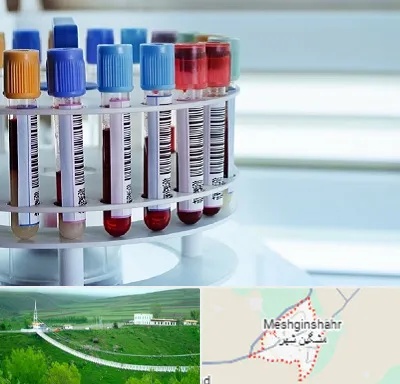 آزمایشگاه ژنتیک در مشگین شهر