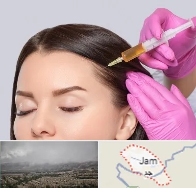 تزریق هیر فیلر در جم