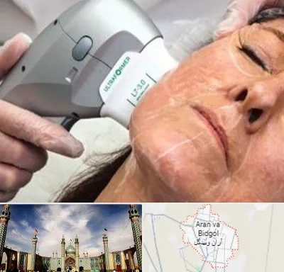 آموزش هایفوتراپی در آران و بیدگل