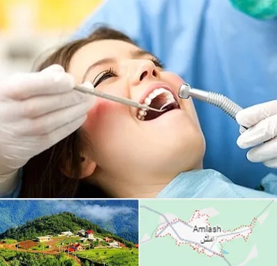 کلینیک دندانپزشکی در املش