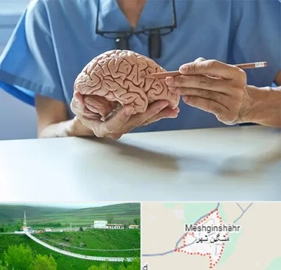 دکتر نورولوژی در مشگین شهر