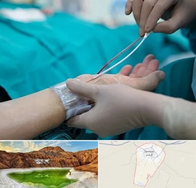 آنژیوگرافی در گرمسار