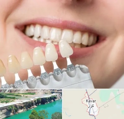مرکز کامپوزیت دندان در کوار