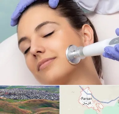 پلاسما جت در فارسان