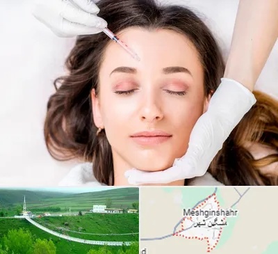 مزوتراپی ابرو در مشگین شهر