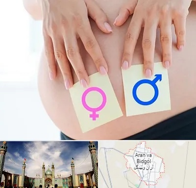 کلینیک تعیین جنسیت در آران و بیدگل
