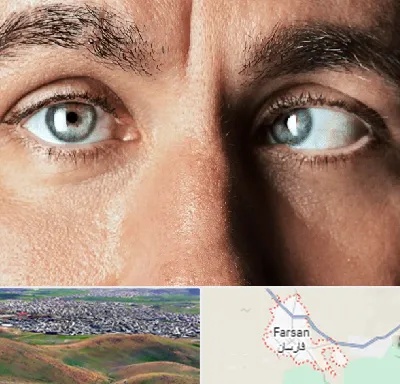 فوق تخصص استرابیسم در فارسان