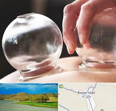 مرکز حجامت در بستان آباد