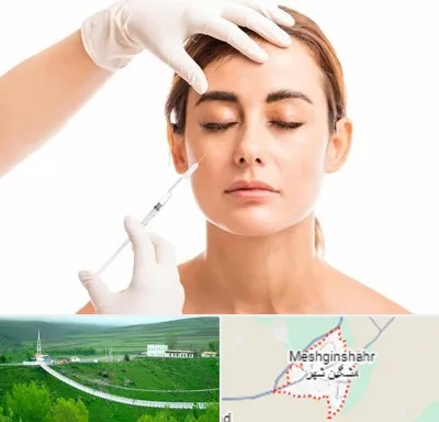 تزریق ژل گونه در مشگین شهر