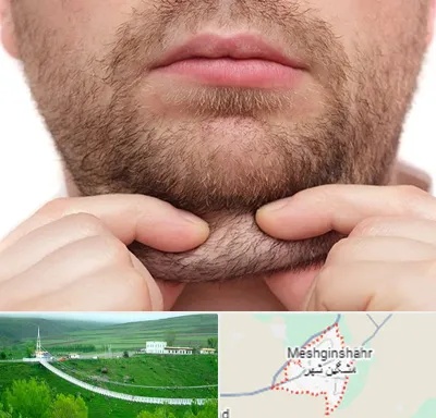 ساکشن غبغب در مشگین شهر