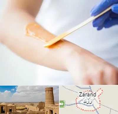 اپیلاسیون کار در زرند