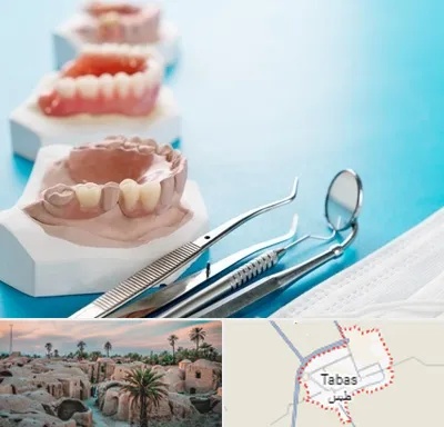 متخصص روکش دندان در طبس