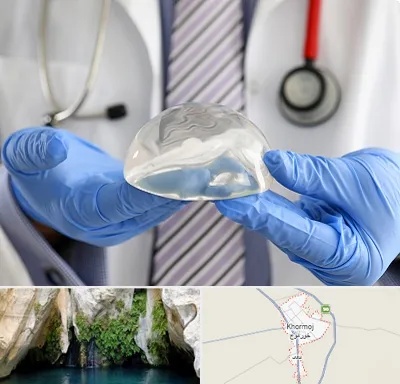 ماموپلاستی در خورموج