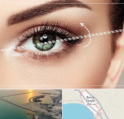 جراحی چشم گربه ای در بندر کنگان
