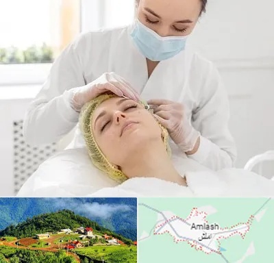 کلینیک زیبایی در املش